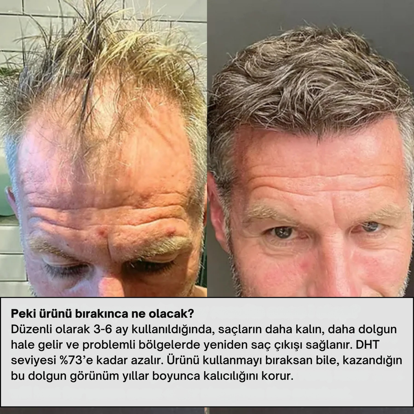 Alpha™ ile Saçını Yeniden Canlandır