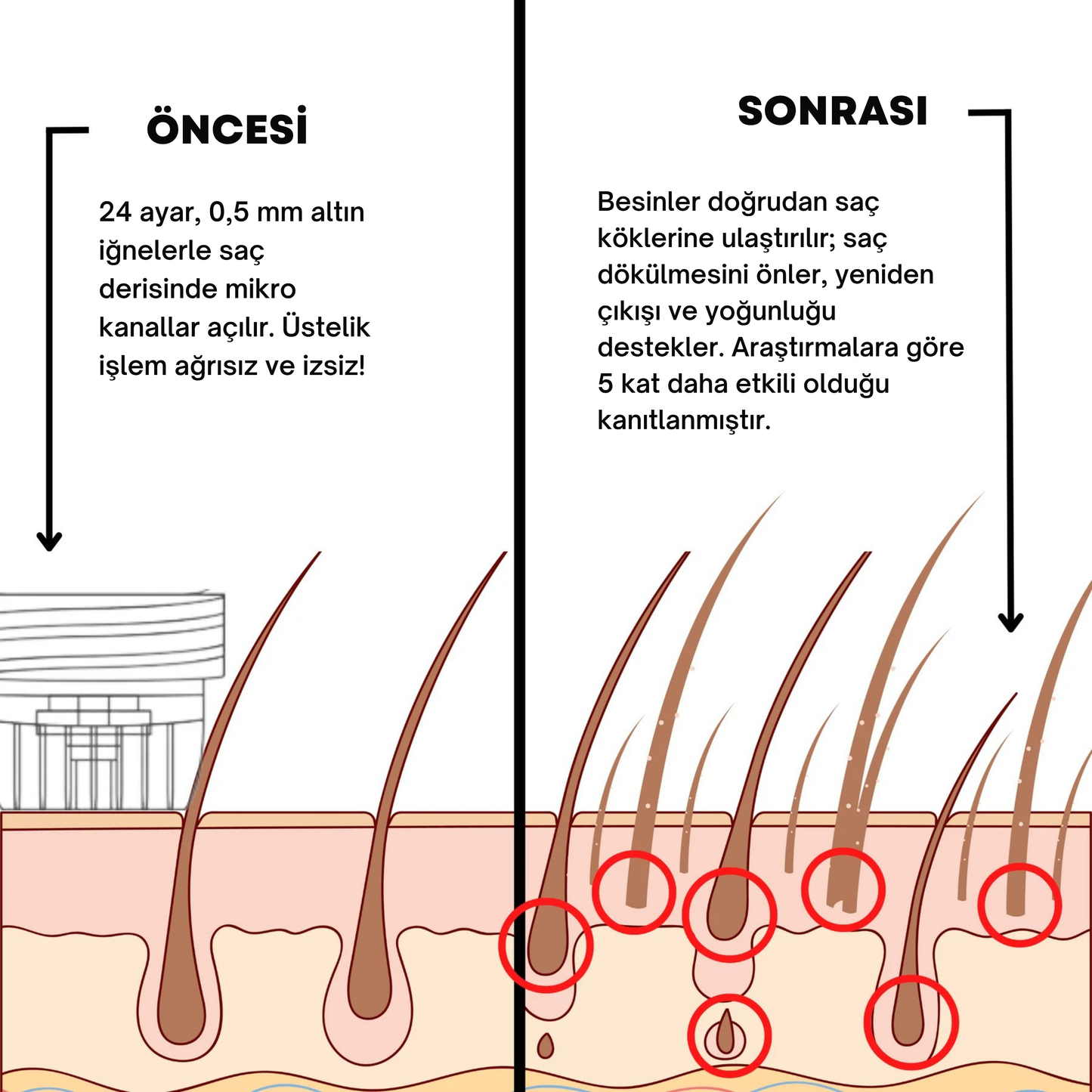 Alpha™ ile Saçını Yeniden Canlandır
